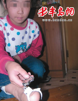 8岁小女孩蒙蒙玩父亲的钢制仿真玩具手铐时,被铐住了右脚拇指