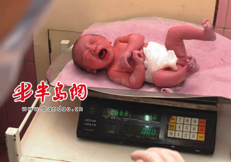 袖珍妈妈昨产下满分女婴 孩子体重2600克